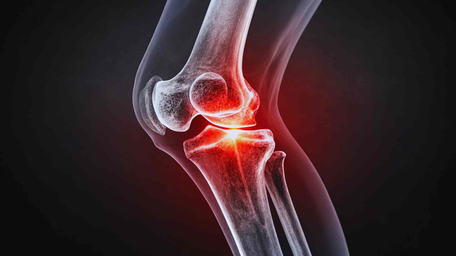 Clínica de la Rodilla en Mexicali